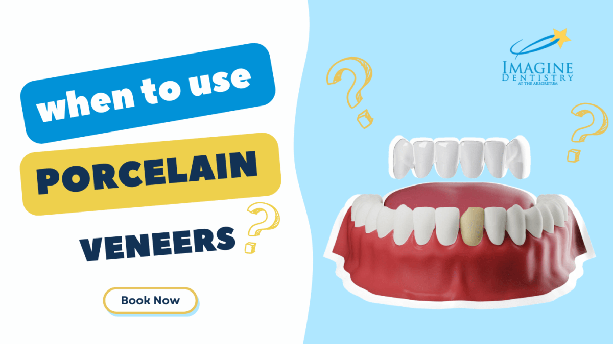 When To Use Porcelain Veneers in Charlotte, NC