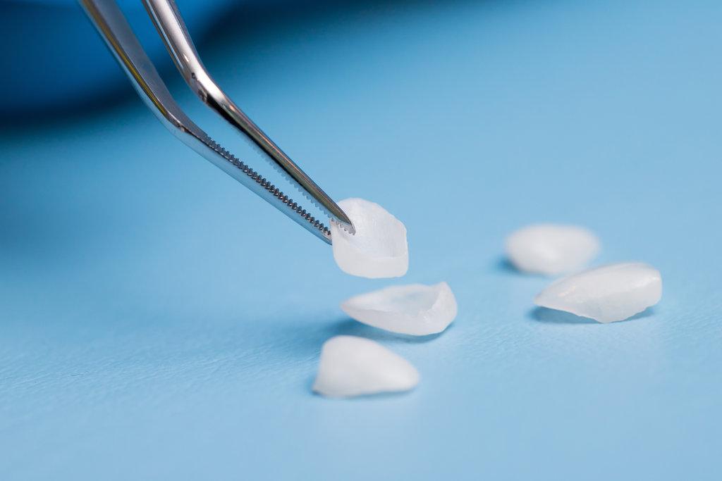 The dentist holds a veneer with tweezers on the background of lying veneers on the table. Close-up