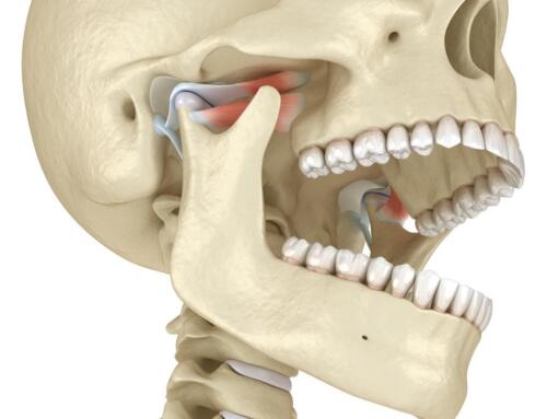TMJ Disorder Signs: When Jaw Pain Requires Professional Treatment