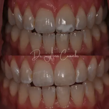 K.Watson - Imagine Dentistry