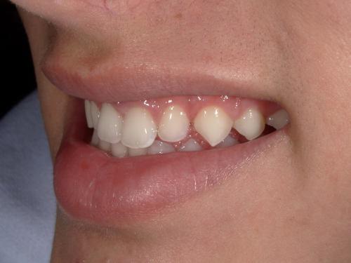 Vin BEFORE - Imagine Dentistry