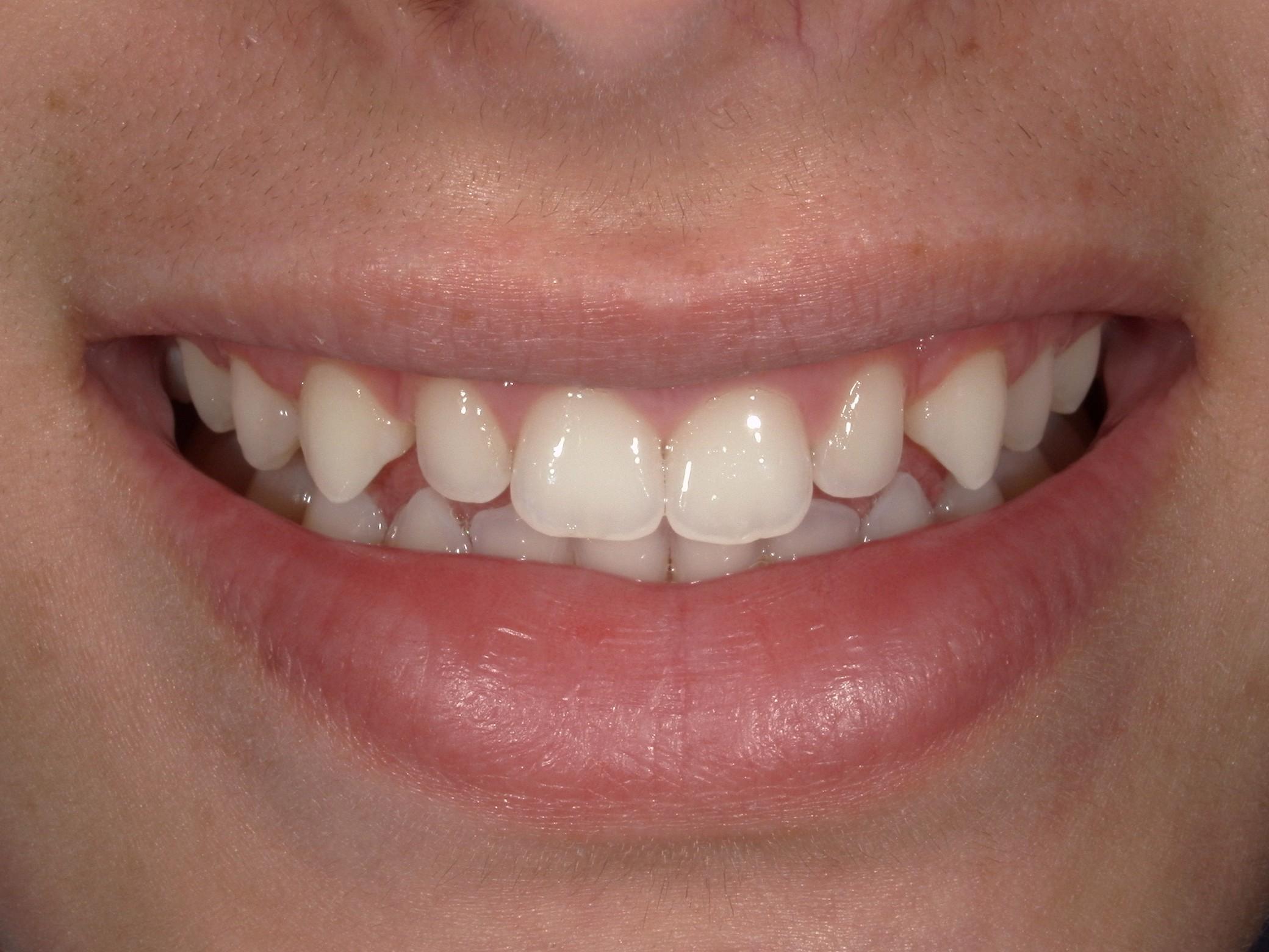 before - Imagine Dentistry